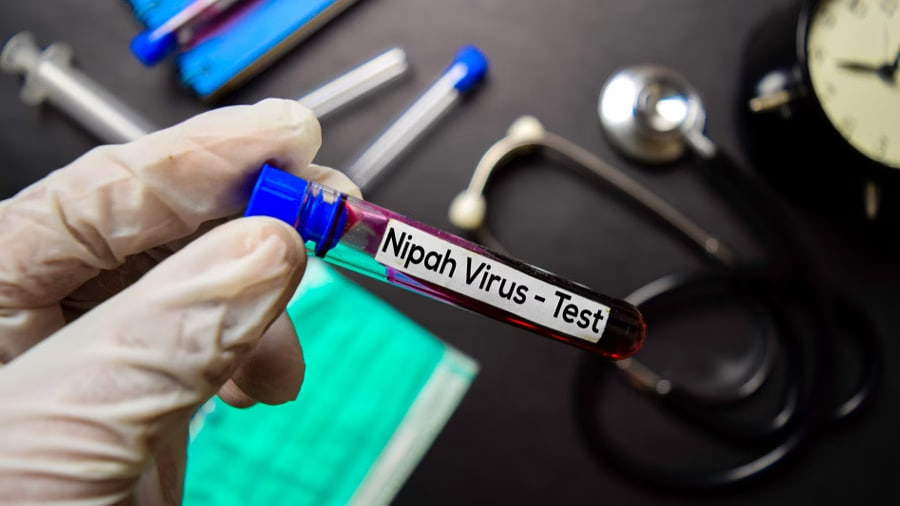 Uzbekistan steps up vigilance as Nipah virus spreads in India.