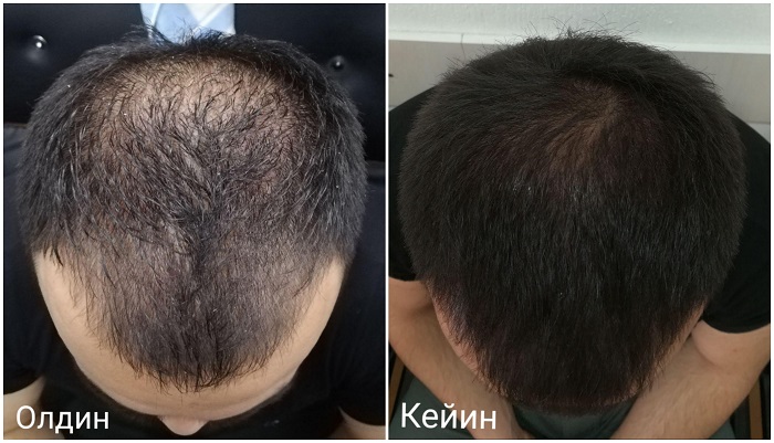 Oq mini shorti va taytdagi qiz Qattiq leggings kiygan ayol jinsiy aloqada bolgan onlayn video